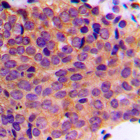 19 - Anti-Cytokeratin 19 Antibody AP51310