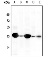 1 - Anti-Cytokeratin 19 Antibody AP51310