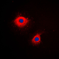 3 - Anti-Cytokeratin 7 Antibody [KO/KD Validated] AP51311