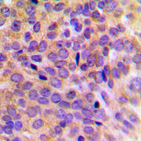 19 - Anti-Cytokeratin 7 Antibody [KO/KD Validated] AP51311