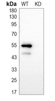 0 - Anti-Cytokeratin 7 Antibody [KO/KD Validated] AP51311