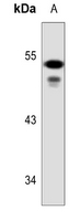 1 - Anti-Cytokeratin 7 Antibody [KO/KD Validated] AP51311
