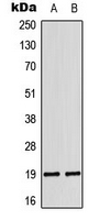 1 - Anti-LATH Antibody AP51314
