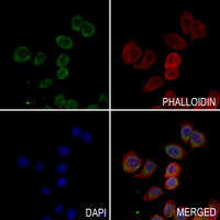 3 - Anti-SLP76 Antibody AP51315