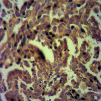 19 - Anti-SLP76 Antibody AP51315