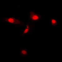 3 - Anti-Galectin 3 Antibody [KO/KD Validated] AP51316