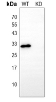0 - Anti-Galectin 3 Antibody [KO/KD Validated] AP51316