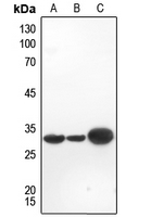 1 - Anti-Galectin 3 Antibody [KO/KD Validated] AP51316