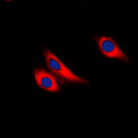 3 - Anti-Galectin 9 Antibody AP51317