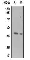 1 - Anti-Galectin 9 Antibody AP51317