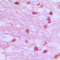 19 - Anti-DNA Ligase 4 Antibody AP51318