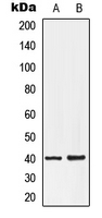 1 - Anti-EDG7 Antibody AP51321