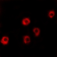 3 - Anti-LPHN2 Antibody AP51322