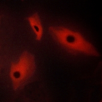 3 - Anti-LTBR Antibody AP51323