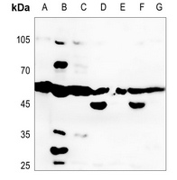 1 - Anti-LTBR Antibody AP51323