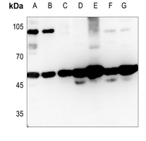 1 - Anti-MAGEC2 Antibody AP51326