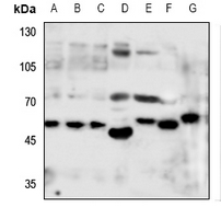 1 - Anti-Monoamine Oxidase A Antibody AP51327
