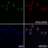 3 - Anti-MARCKS (Phospho-S163) Antibody AP51329