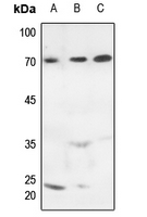 1 - Anti-MARCKS (Phospho-S163) Antibody AP51329