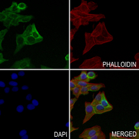 3 - Anti-MASP1 HC Antibody AP51330