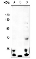 1 - Anti-MASP1 HC Antibody AP51330