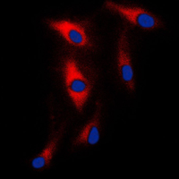 3 - Anti-MAST2 Antibody AP51331