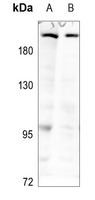 1 - Anti-MAST2 Antibody AP51331