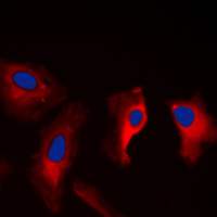 3 - Anti-MAST3 Antibody AP51332