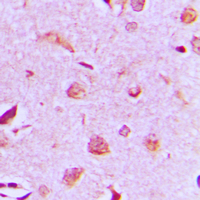 19 - Anti-MAST3 Antibody AP51332