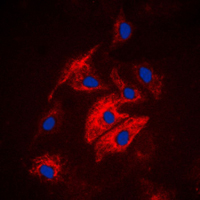 3 - Anti-MAST4 Antibody AP51333