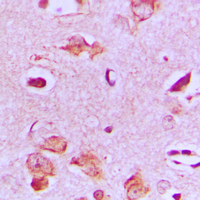 19 - Anti-MAST4 Antibody AP51333