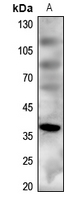 1 - Anti-MC4 Receptor Antibody AP51334