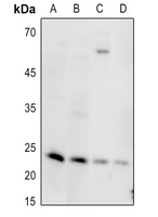 1 - Anti-MED18 Antibody AP51339