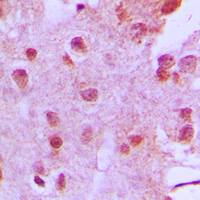 19 - Anti-Menin Antibody AP51340