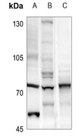 1 - Anti-Menin Antibody AP51340