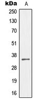 1 - Anti-MEOX2 Antibody AP51341