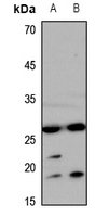 1 - Anti-Aquaporin 0 Antibody AP51342