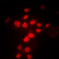 3 - Anti-MLH1 Antibody AP51343