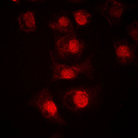 3 - Anti-TCFL4 Antibody AP51344