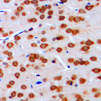 19 - Anti-TCFL4 Antibody AP51344