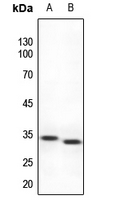 1 - Anti-TCFL4 Antibody AP51344