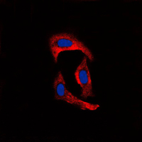 3 - Anti-MMP1 Antibody AP51345