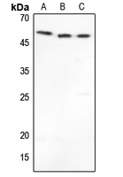 1 - Anti-MMP1 Antibody AP51345