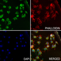 3 - Anti-MMP1 22k Antibody AP51346