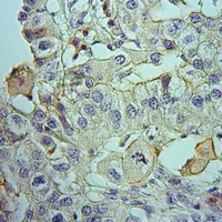 19 - Anti-MMP1 22k Antibody AP51346