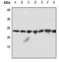 1 - Anti-MMP1 22k Antibody AP51346