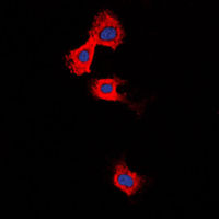 3 - Anti-MMP11 Antibody AP51347