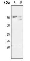 1 - Anti-MMP11 Antibody AP51347