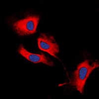 3 - Anti-MMP13 Antibody AP51348