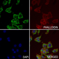 3 - Anti-MMP14 Antibody AP51349